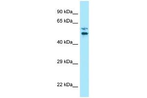 WB Suggested Anti-LTV1 Antibody Titration: 1. (LTV1 Antikörper  (C-Term))