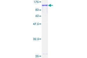 Image no. 2 for Eukaryotic Elongation Factor-2 Kinase (EEF2K) (AA 1-725) protein (GST tag) (ABIN1352365)