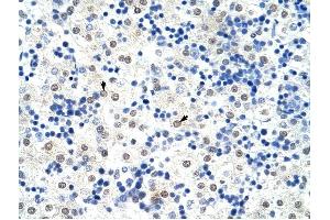 HNRPL antibody was used for immunohistochemistry at a concentration of 4-8 ug/ml to stain Hepatocytes (arrows) in Human Liver. (HNRNPL Antikörper  (N-Term))