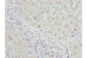 Immunohistochemistry of paraffin-embedded human liver tissue using ABIN7154996 at dilution of 1:100 (HBZ Antikörper  (AA 1-142))