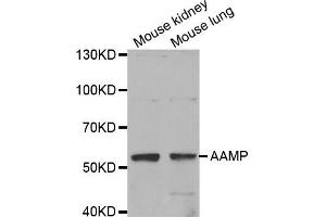 Western Blotting (WB) image for anti-Angio-Associated, Migratory Cell Protein (AAMP) antibody (ABIN1875463)