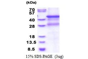 SDS-PAGE (SDS) image for Matrix Metallopeptidase 8 (Neutrophil Collagenase) (MMP8) (AA 101-467) protein (His tag) (ABIN5853524)