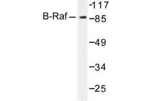 Image no. 2 for anti-B-Raf proto-oncogene, serine/threonine kinase (BRAF) antibody (ABIN271999) (BRAF Antikörper)