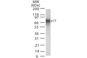 p73 Western Blot.