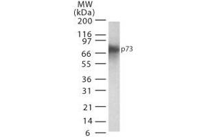 p73 Western Blot. (Tumor Protein p73 Antikörper)