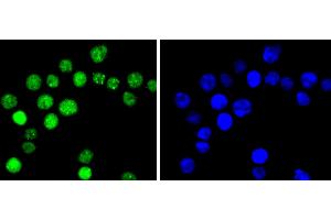 SW480 cells were stained with Cyclin E1(T77) (4G10 ) Monoclonal Antibody  at [1:200] incubated overnight at 4C, followed by secondary antibody incubation, DAPI staining of the nuclei and detection. (Cyclin E1 Antikörper  (pThr77))