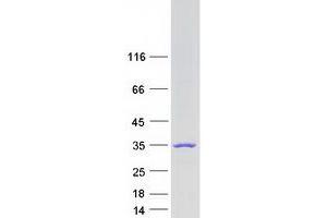 Western Blotting (WB) image for Methyltransferase Like 21D (METTL21D) (Transcript Variant 1) protein (Myc-DYKDDDDK Tag) (ABIN2714055)