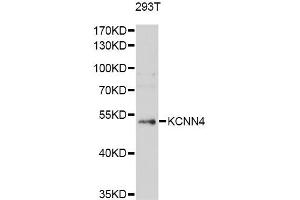 Western blot analysis of extracts of 293T cells, using KCNN4 antibody (ABIN5971024) at 1/1000 dilution. (KCNN4 Antikörper)