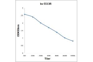 ELISA image for anti-Nuclear Factor of kappa Light Polypeptide Gene Enhancer in B-Cells 1 (NFKB1) (pSer893) antibody (ABIN710666)