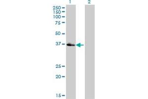 Western Blotting (WB) image for anti-POU Domain, Class 4, Transcription Factor 3 (POU4F3) (AA 100-190) antibody (ABIN562325)