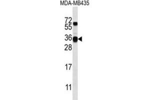 Western Blotting (WB) image for anti-Casein beta (CSN2) antibody (ABIN2996884) (CSN2 Antikörper)