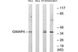 Western Blotting (WB) image for anti-GTPase, IMAP Family Member 4 (GIMAP4) (AA 131-180) antibody (ABIN2890361) (GIMAP4 Antikörper  (AA 131-180))