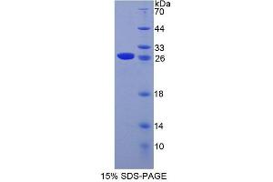 SDS-PAGE analysis of Mouse MCM3 Protein. (MCM3 Protein)