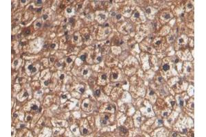 DAB staining on IHC-P; Samples: Human Liver Tissue (HPR Antikörper  (AA 102-347))