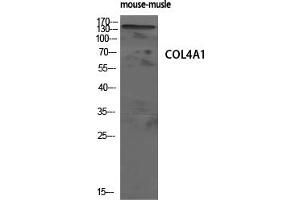 Western Blotting (WB) image for anti-Collagen, Type IV, alpha 1 (COL4A1) (N-Term) antibody (ABIN7188644)