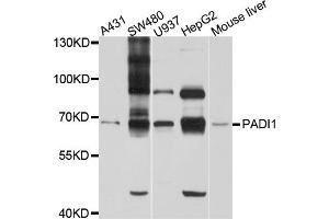 Western blot analysis of extracts of various cell lines, using PADI1 antibody (ABIN6003843) at 1/1000 dilution. (PADI1 Antikörper)