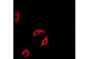 Immunofluorescent analysis of Centrin-2 staining in MCF7 cells.