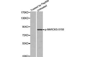 Western Blotting (WB) image for anti-Myristoylated Alanine-Rich Protein Kinase C Substrate (MARCKS) (pSer158) antibody (ABIN1870416) (MARCKS Antikörper  (pSer158))