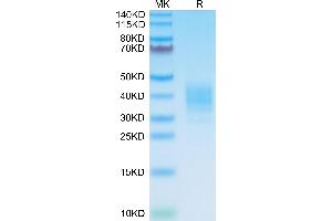 SDS-PAGE (SDS) image for SLAM Family Member 7 (SLAMF7) (AA 23-224) protein (His tag) (ABIN7275634)