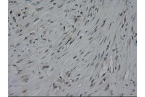 Immunohistochemical staining of paraffin-embedded colon using anti-IL-3 (ABIN2452543) mouse monoclonal antibody.