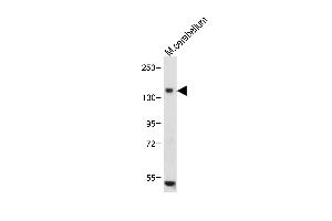 Anti-c-KIT Antibody (N-term) at 1:1000 dilution+ Mouse cerebellum tissue lysate Lysates/proteins at 20 μg per lane. (KIT Antikörper  (N-Term))