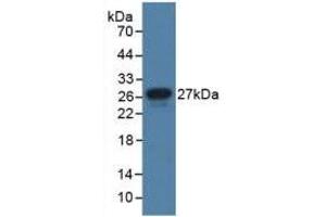 Western blot analysis of recombinant Human JAM1. (F11R Antikörper  (AA 64-249))