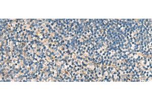 Immunohistochemistry of paraffin-embedded Human tonsil tissue using ACTC1 Polyclonal Antibody at dilution of 1:55(x200) (ACTC1 Antikörper)