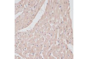 Immunohistochemistry of paraffin-embedded rat heart using PRPF31 antibody (ABIN6132996, ABIN6146262, ABIN6146264 and ABIN6221399) at dilution of 1:100 (40x lens).