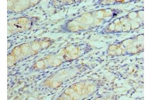 Immunohistochemistry of paraffin-embedded human colon tissue using ABIN7154290 at dilution of 1:100 (GOLM1 Antikörper  (AA 112-401))
