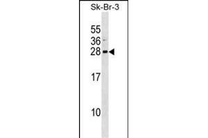 ARL1 Antibody (Center) (ABIN1538637 and ABIN2848485) western blot analysis in SK-BR-3 cell line lysates (35 μg/lane). (ARL1 Antikörper  (AA 81-108))