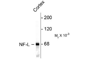 Western blots of rat cortex lysate showing specific immunolableing of the ~ 68k NF-L protein. (NEFL Antikörper)
