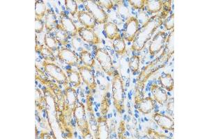 Immunohistochemistry of paraffin-embedded mouse kidney using  antibody (ABIN6129195, ABIN6137096, ABIN6137097 and ABIN6220538) at dilution of 1:100 (40x lens). (ARHGEF5 Antikörper  (AA 1248-1597))