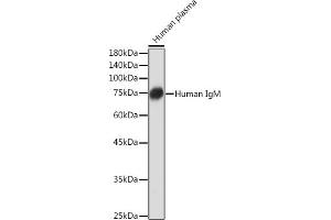 Western blot analysis of extracts of Human plasma, using Human IgM Rabbit mAb (ABIN7267845) at 1:1000 dilution. (IGHM Antikörper)