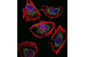 Fluorescent confocal image of Hela cell stained with SOX4 Antibody (N-term) (ABIN388786 and ABIN2839119). (SOX4 Antikörper  (N-Term))