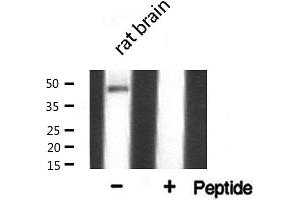 Western blot analysis of AP 2 expression in COLO205 cells (TFAP2A Antikörper  (C-Term))