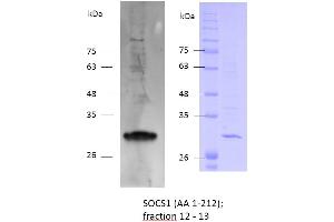 Image no. 2 for Suppressor of Cytokine Signaling 1 (SOCS1) (AA 1-212) protein (Strep Tag) (ABIN3147837) (SOCS1 Protein (AA 1-212) (Strep Tag))