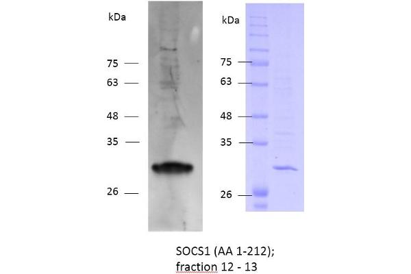 SOCS1 Protein (AA 1-212) (Strep Tag)