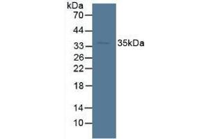 Detection of SDH in Mouse Liver Tissue using Polyclonal Antibody to Sorbitol Dehydrogenase (SDH) (SORD Antikörper  (AA 98-355))