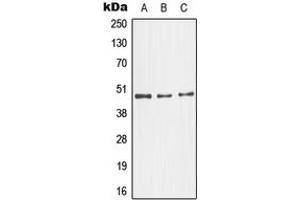 Western blot analysis of JNK3 expression in NIH3T3 (A), SKNSH (B), HeLa (C) whole cell lysates. (MAPK10 Antikörper  (C-Term))