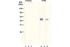 Treatment of A549 cells with the histone deacetylase inhibitor trichostatin A (TSA, 0. (alpha Tubulin Antikörper  (acLys40))