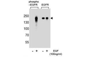 Western blot analysis of extracts from A431 cells, untreated or treated with EGF, using phospho-EGFR antibody (left) or nonphos Ab (right)