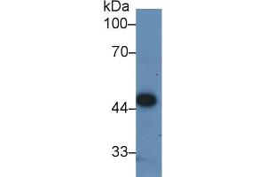 Detection of PDHA1 in Human ECV304 cell lysate using Polyclonal Antibody to Pyruvate dehydrogenase alpha 1 (PDHA1) (PDHA1 Antikörper  (AA 30-390))