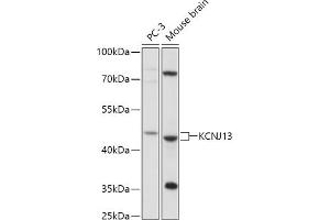 Western blot analysis of extracts of various cell lines, using KCNJ13 antibody (ABIN7269473) at 1:1000 dilution. (KCNJ13 Antikörper  (AA 160-360))