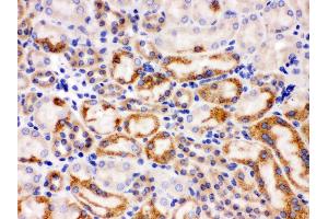 Immunohistochemistry (IHC) image for anti-Wingless-Type MMTV Integration Site Family, Member 7A (WNT7A) (AA 226-256), (C-Term) antibody (ABIN3042348)
