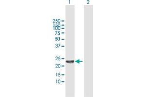 Western Blot analysis of SENP8 expression in transfected 293T cell line by SENP8 MaxPab polyclonal antibody. (SENP8 Antikörper  (AA 1-212))