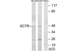 Western blot analysis of extracts from HeLa cells and HUVEC cells, using SCTR antibody. (SCTR Antikörper  (Internal Region))