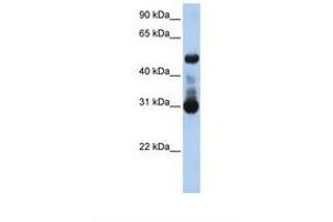 Image no. 1 for anti-Activin A Receptor Type II-Like 1 (ACVRL1) (AA 38-87) antibody (ABIN6738113)