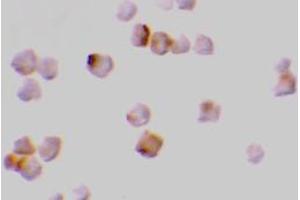 Immunocytochemistry of caspase-2 in A-20 cells with AP30196PU-N caspase-2 antibody at 2 μg/ml. (Caspase 2 Antikörper  (N-Term))