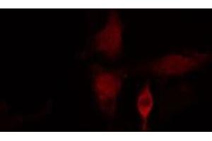 ABIN6275415 staining  HuvEc cells by IF/ICC. (SSH3 Antikörper  (Internal Region))