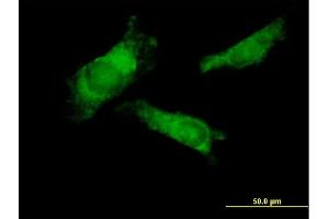 Immunofluorescence of purified MaxPab antibody to RNF14 on HeLa cell. (RNF14 Antikörper  (AA 1-348))
